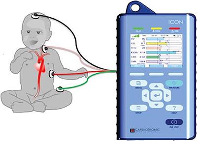 Non-invasive Cardiac Output Monitoring and Assessment of Fluid Responsiveness in Children With Shock in the Emergency Department